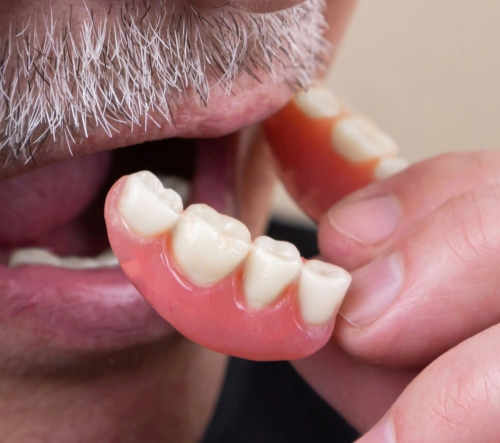 dentures